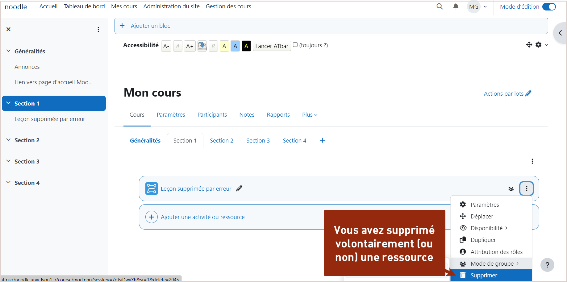 Vous avez supprimé une ressource